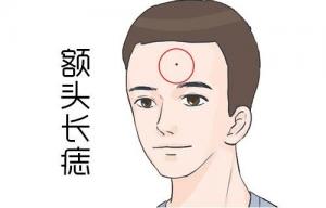 額頭有痣的男人有什么寓意