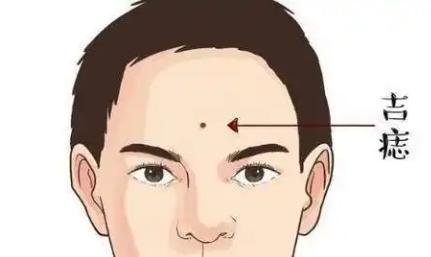 男人臉上哪里長(zhǎng)痣最有福氣？